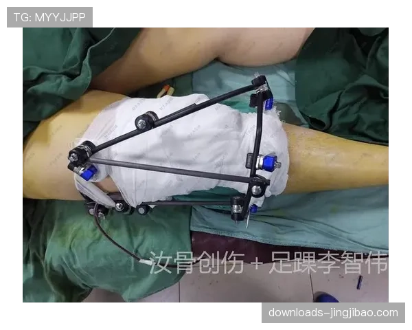 奇克戴橡胶护具复出,米兰中场谈下颌骨折恢复过程 奇克戴橡胶护具复出,米兰中场谈下颌骨折恢复过程